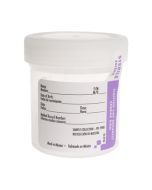 Urine Cups 